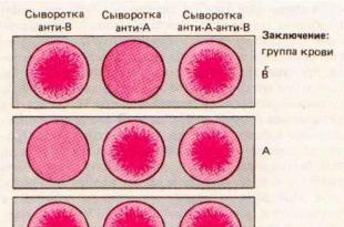 Зачатие (резус-фактор крови)